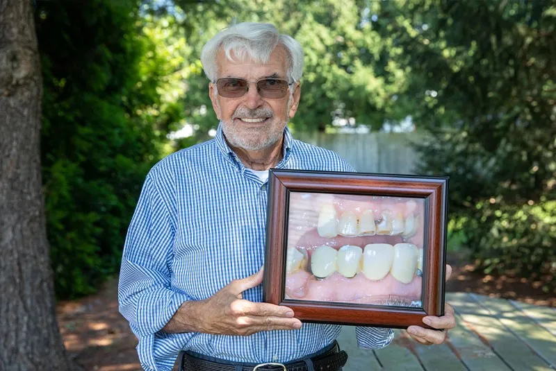 George - All-On-X Patient