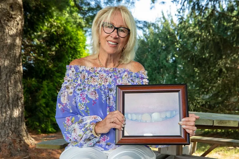 Pat - All-On-X Patient