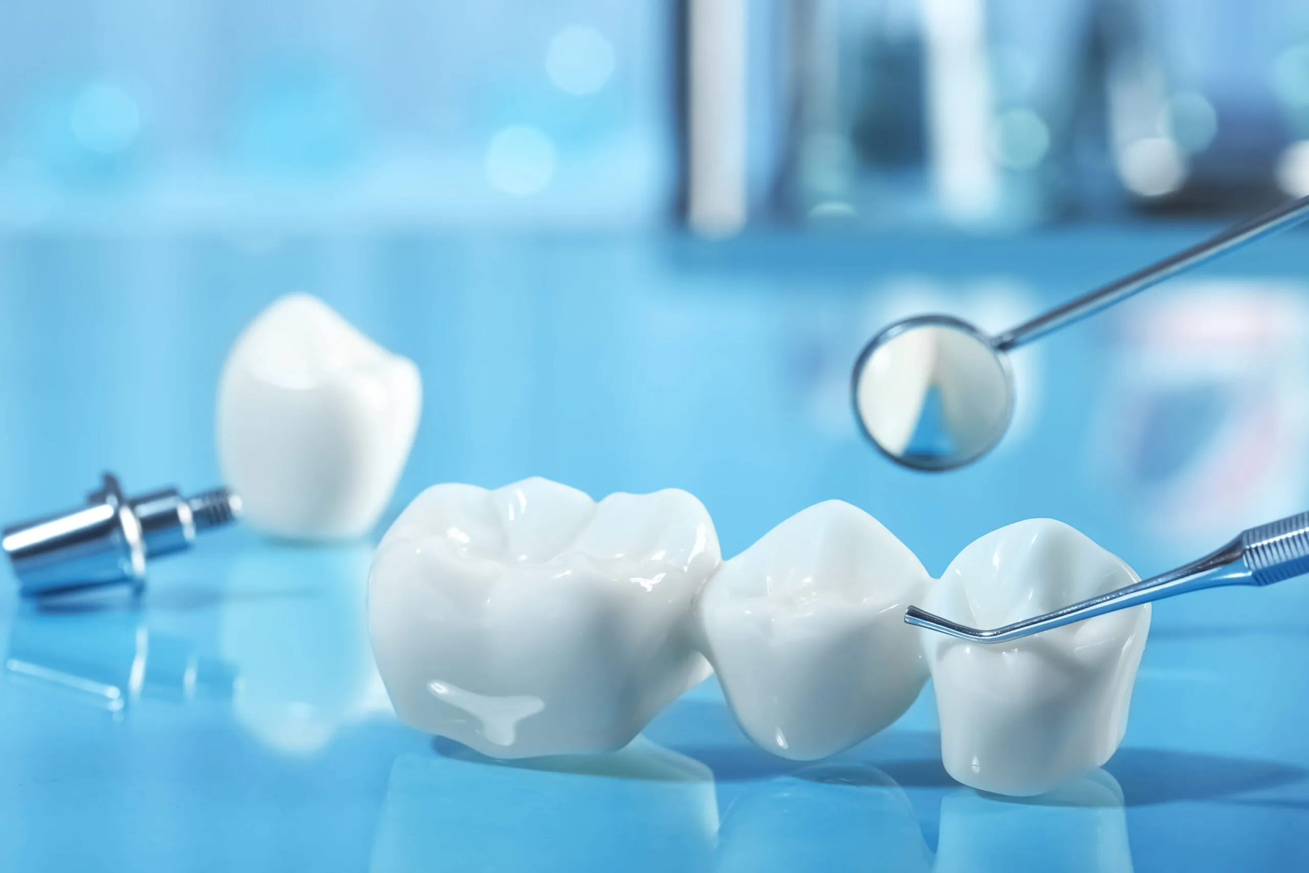 What Is the Difference Between Same-Day Crowns and Traditional Crowns?