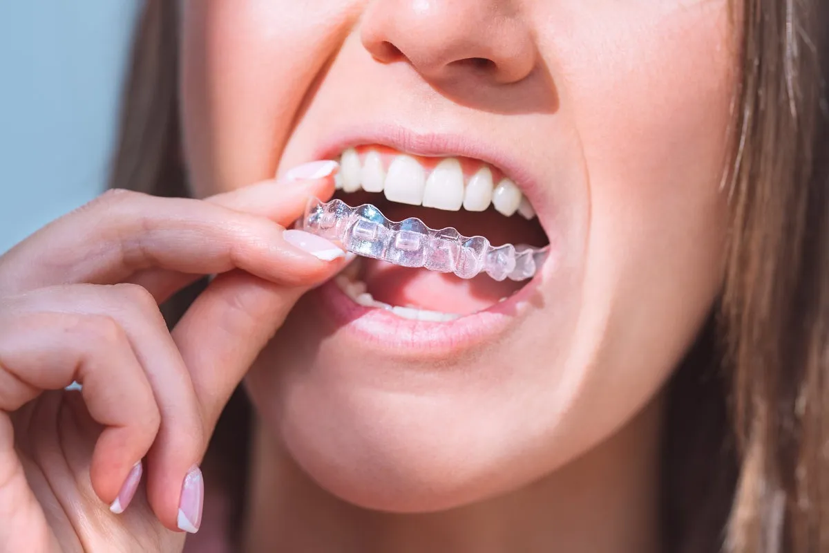 Myths About Invisalign Debunked