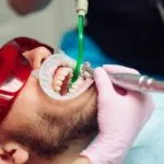 Professional teeth cleaning. Dentist cleans the teeth of a male patient.