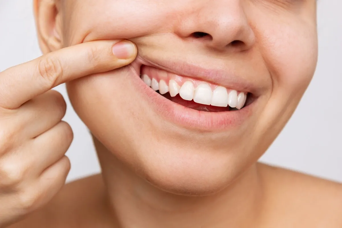 How Does Stress Impact Gum Health?